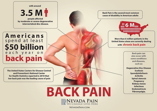 back pain infographic